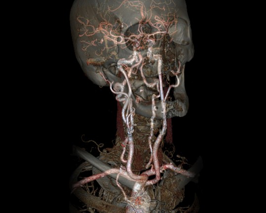 Computertomographie (CT)